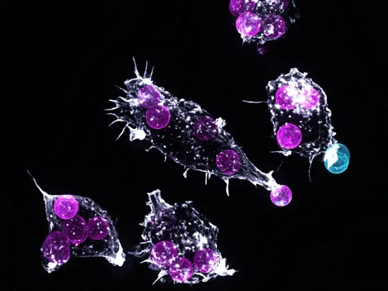 Microscope image of organism